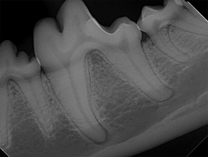 dental 5